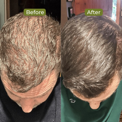 Premium Batana Oil For Hair Growth